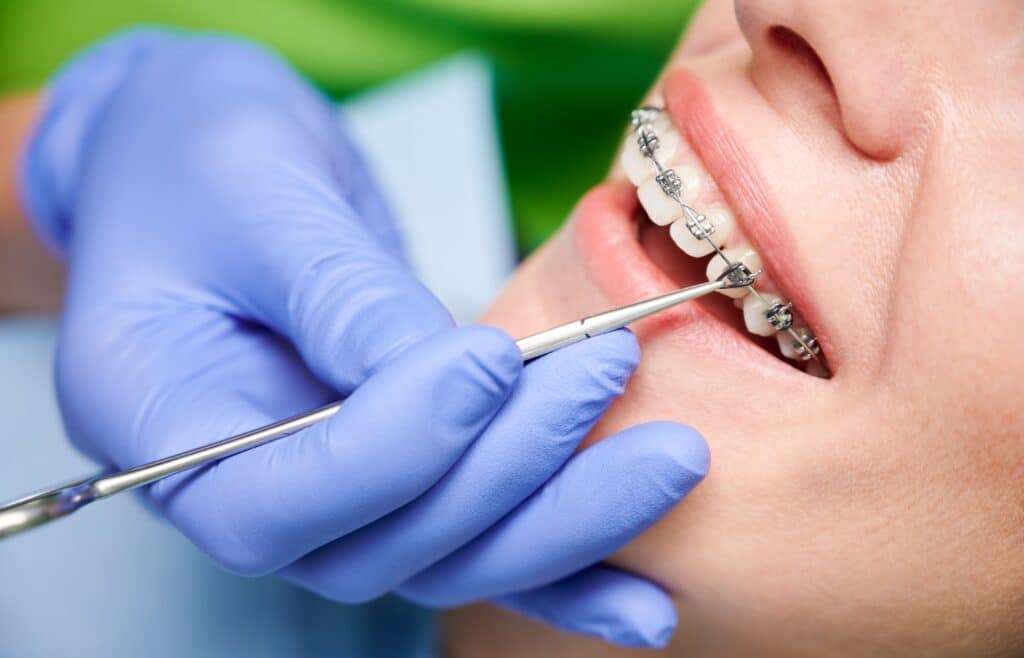Quels sont les soins d’orthodontie ?